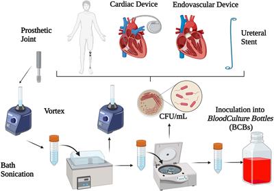 Challenges in the Microbiological Diagnosis of Implant-Associated Infections: A Summary of the Current Knowledge